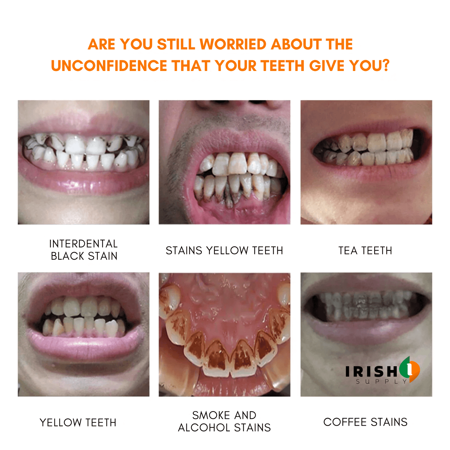 STAINLIFT™ Powerful Instant Whitening Pen