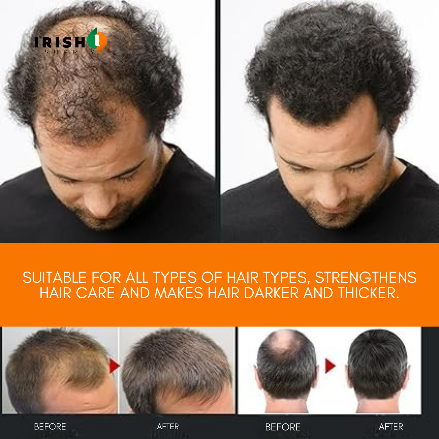 FOLLICORE Root Activating Shampoo (100mL)