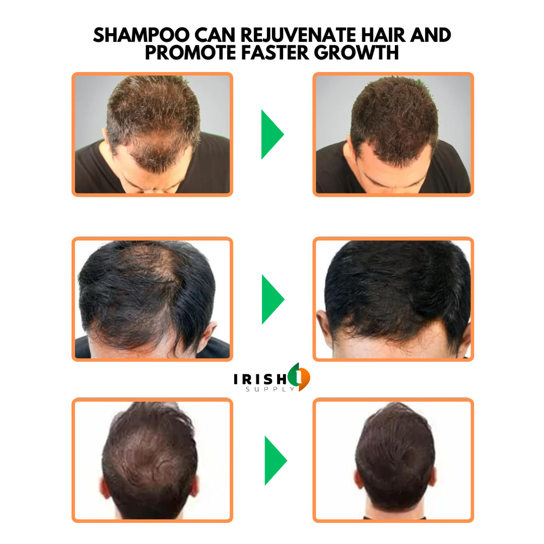 FOLLICORE Root Activating Shampoo (100mL)